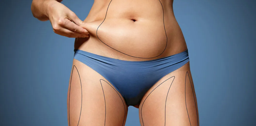 Advanced Body Contouring and Liposuction Surgery Belfast Ireland